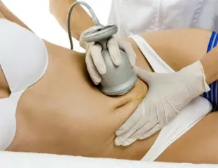 Lipocavitatie Cellulitis behandeling