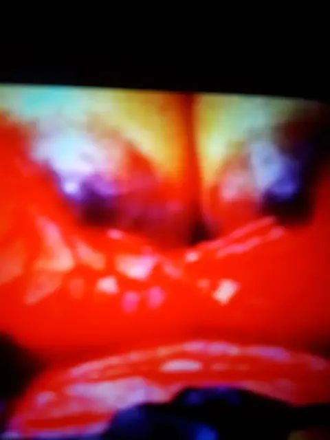 Hoy met sonita 39 jaar doet escordt