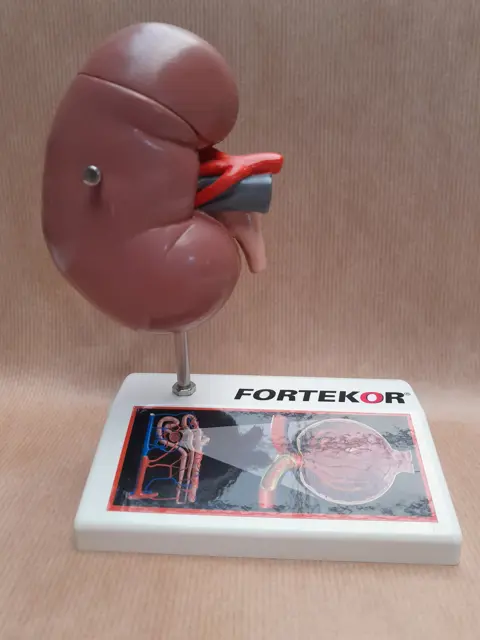 Anatomisch model van een nier