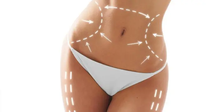 After Lipo Massage behandeling na een cosmetische ingreep