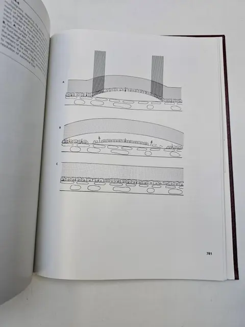 J. Donald M. Gass - Stereoscopic Atlas of Macular Diseases - 1987