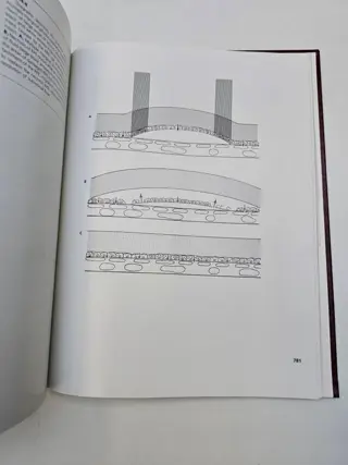 J. Donald M. Gass - Stereoscopic Atlas of Macular Diseases - 1987