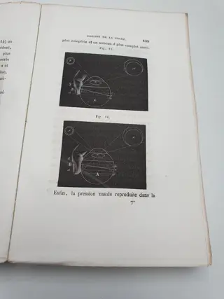Dr. Serre - Essai sur les Phosphènes ou Anneaux Lumineux de la Rétine - 1853