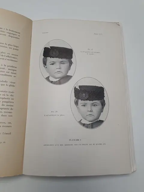 Signed; Robert Coulomb - L’œil artificiel - 1905