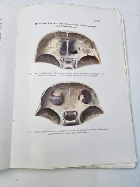 Prof. Dr. A. von Szily - Atlas der Kriegsaugenheilkunde samt begleitendem Text - 1916/1918