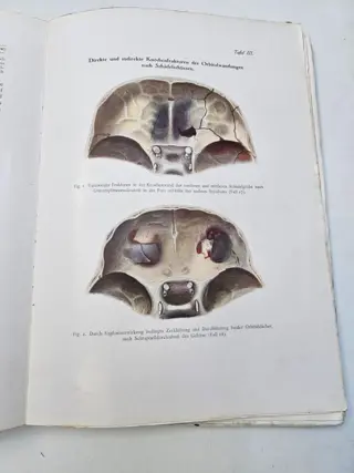 Prof. Dr. A. von Szily - Atlas der Kriegsaugenheilkunde samt begleitendem Text - 1916/1918