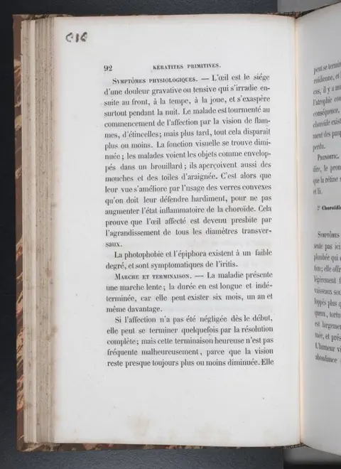 Mirault-G / Wecker, L. / Rück R. /Castorani, Raphaël - cataractes / Kératite - 1856/1868