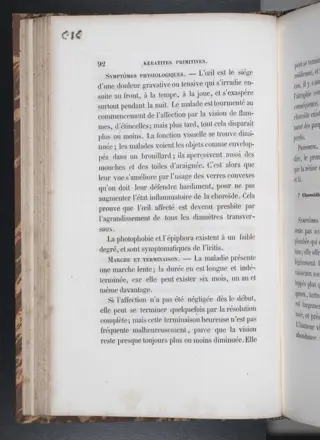 Mirault-G / Wecker, L. / Rück R. /Castorani, Raphaël - cataractes / Kératite - 1856/1868