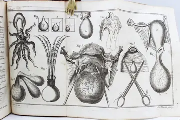 A. Levret - Observations sur la Cure Radicale de plusieurs Polypes de la Matrice, de la Gorge et du Nez - 1771