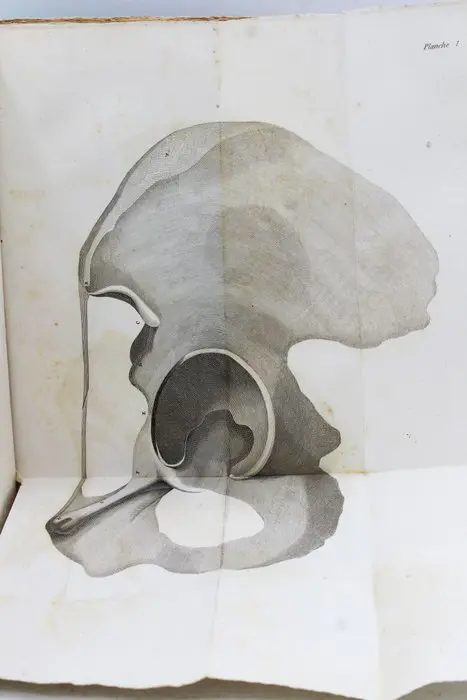 W. Lawrence, F.R.S - Traité Des Hernies - 1818