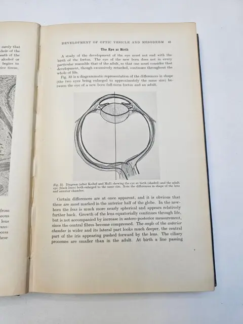 Ida C. Mann - The development of the human eye - 1928