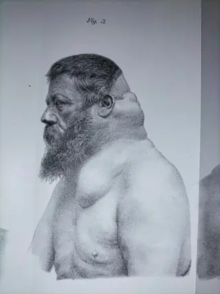 Langenbeck - Clinica chirurgica - 1888