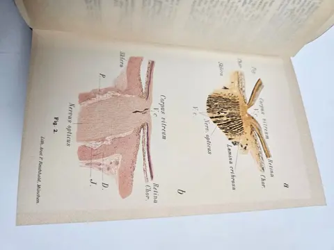 Prof. Dr. O. Haab - Atlas der äusseren Erkrankungen des Auges + Atlas und Grundriss der Ophthalmoscopie - 1899/1904