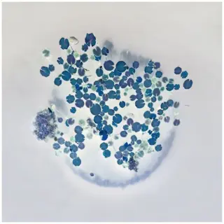 Bernd Lieven - The rise and fall of waterlilies VII